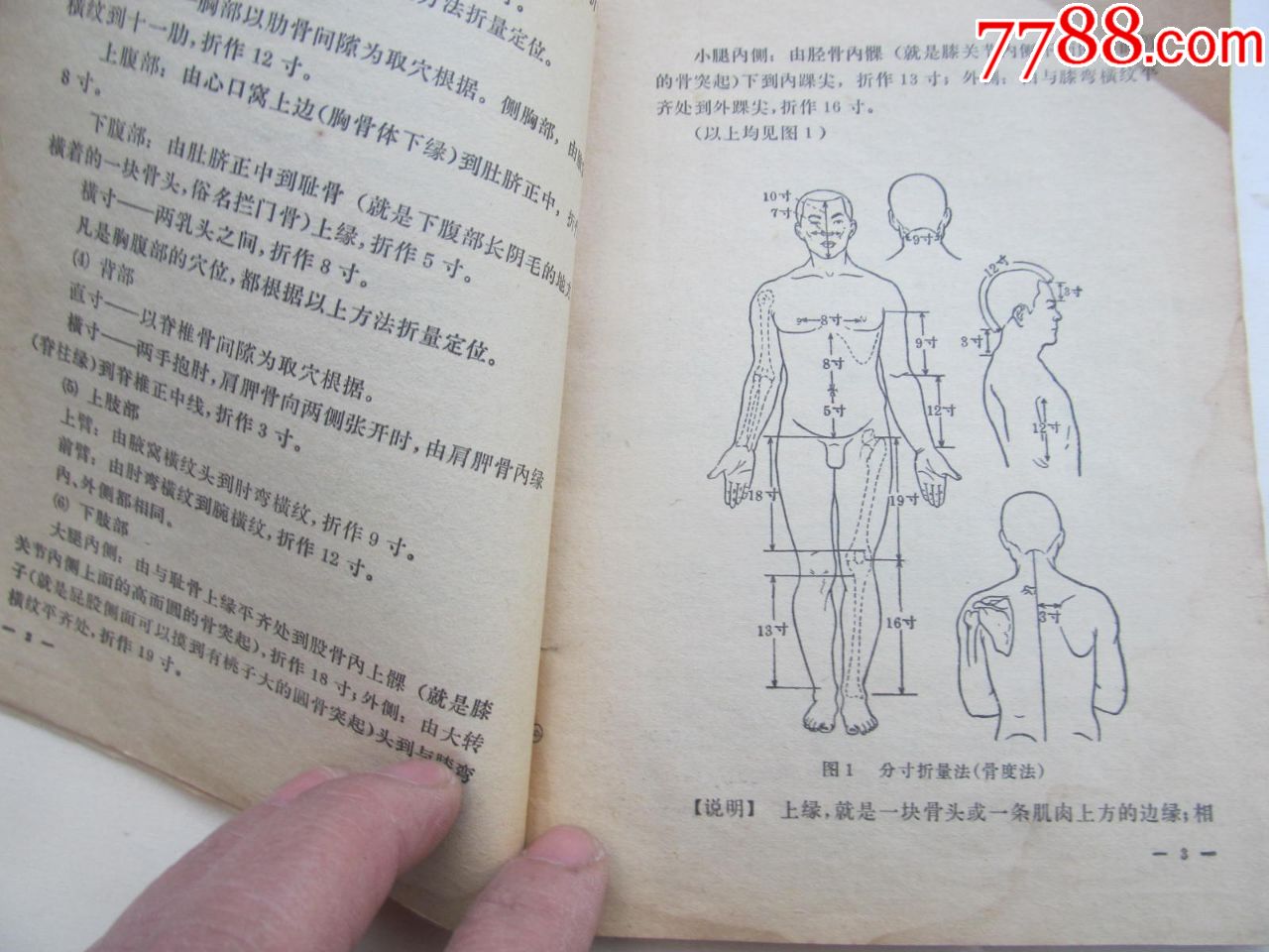 针灸临床取穴图解,每个空位都手写注明神精及动脑血管