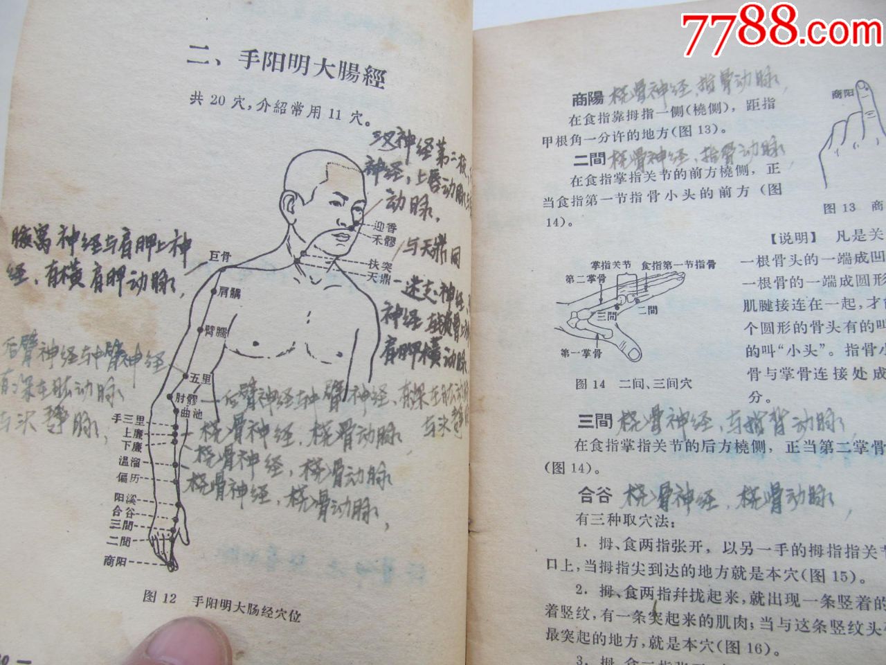 针灸临床取穴图解,每个空位都手写注明神精及动脑血管