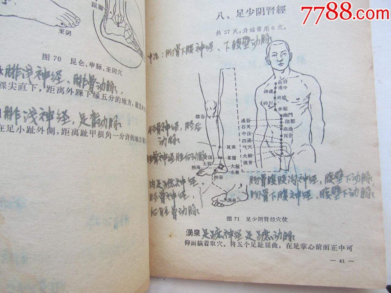 针灸临床取穴图解,每个空位都手写注明神精及动脑血管