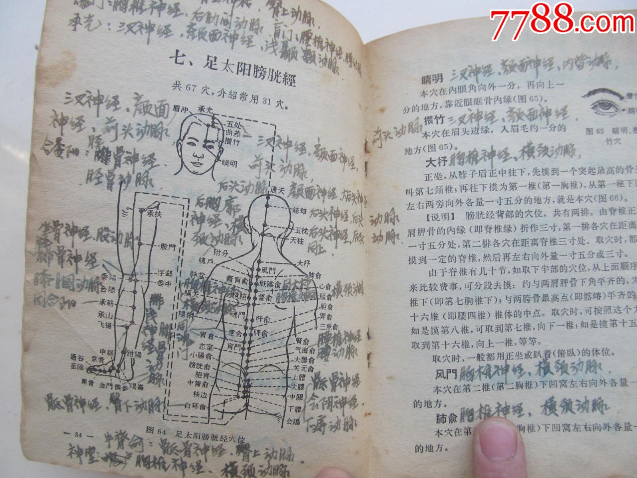 针灸临床取穴图解,每个空位都手写注明神精及动脑血管