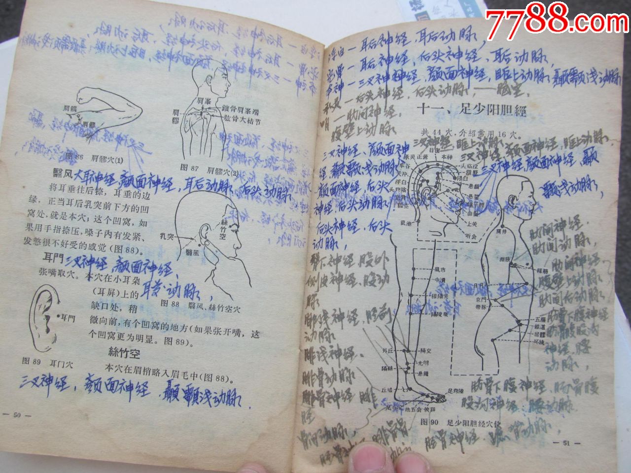 针灸临床取穴图解,每个空位都手写注明神精及动脑血管
