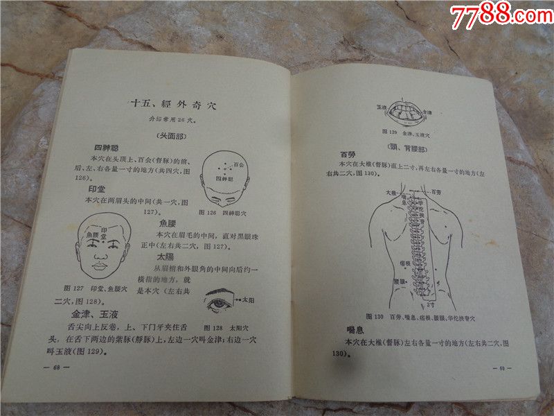 1968年北京中医学院编《针灸临床取穴图解》