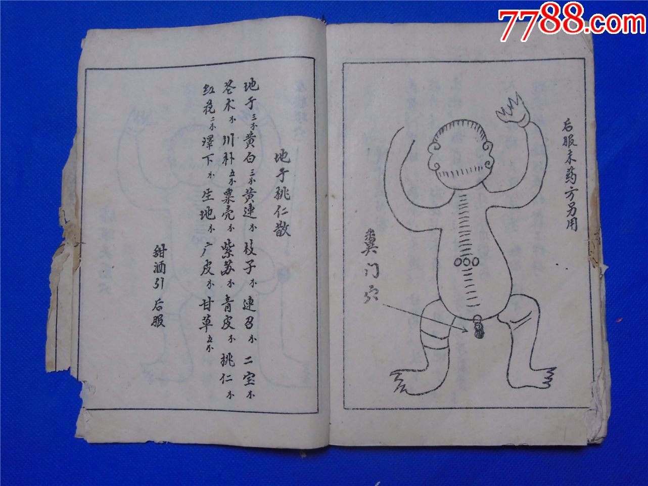特别少见的跌打方药书