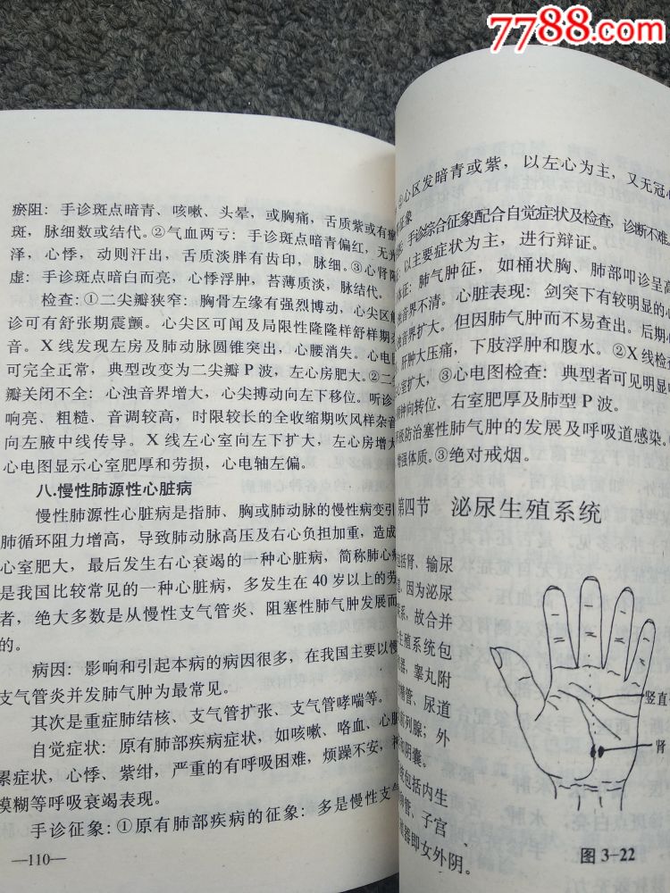 手诊_价格15.0000元_第5张_7788收藏__中国收藏热线