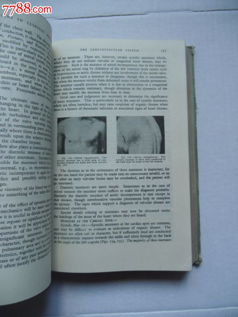 1961年临床症状及体征医用诊断学导论(英文版