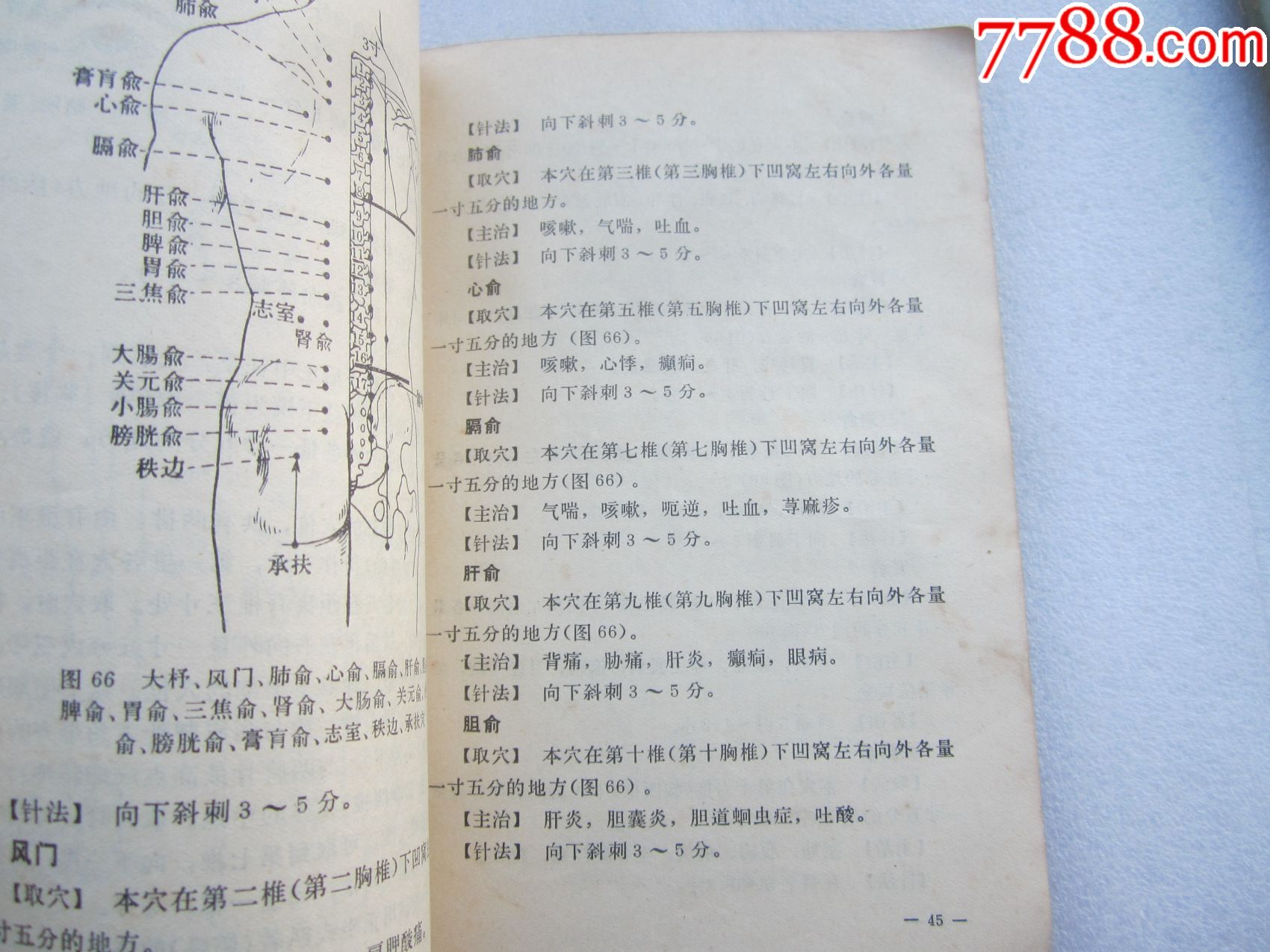 针灸临床取穴图解(文革老中医书,缺少底封)