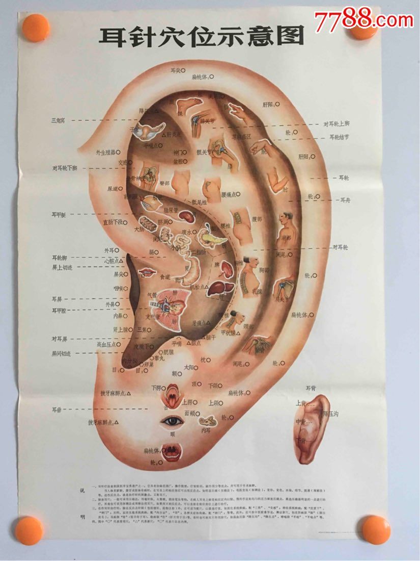 耳针穴位示意图