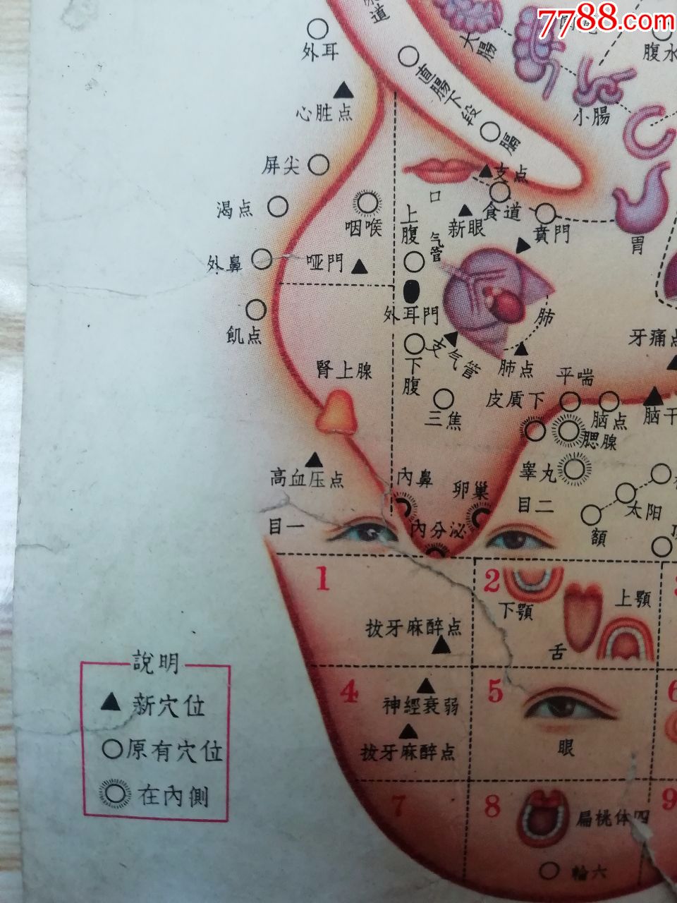 "最高指示"耳针穴位示意图