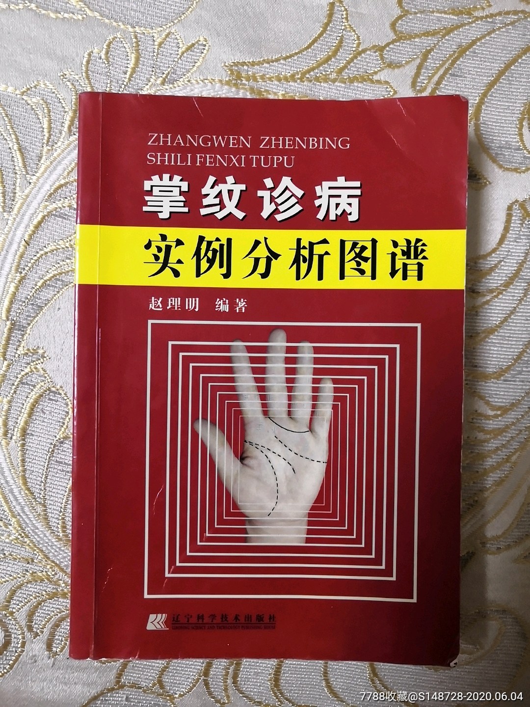 掌纹诊病实例分析图谱