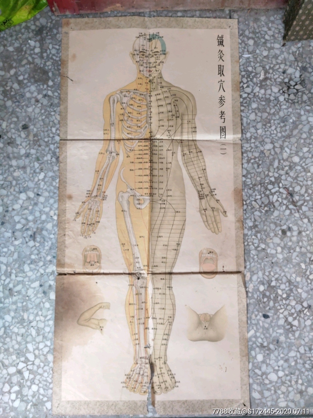 针灸挂图