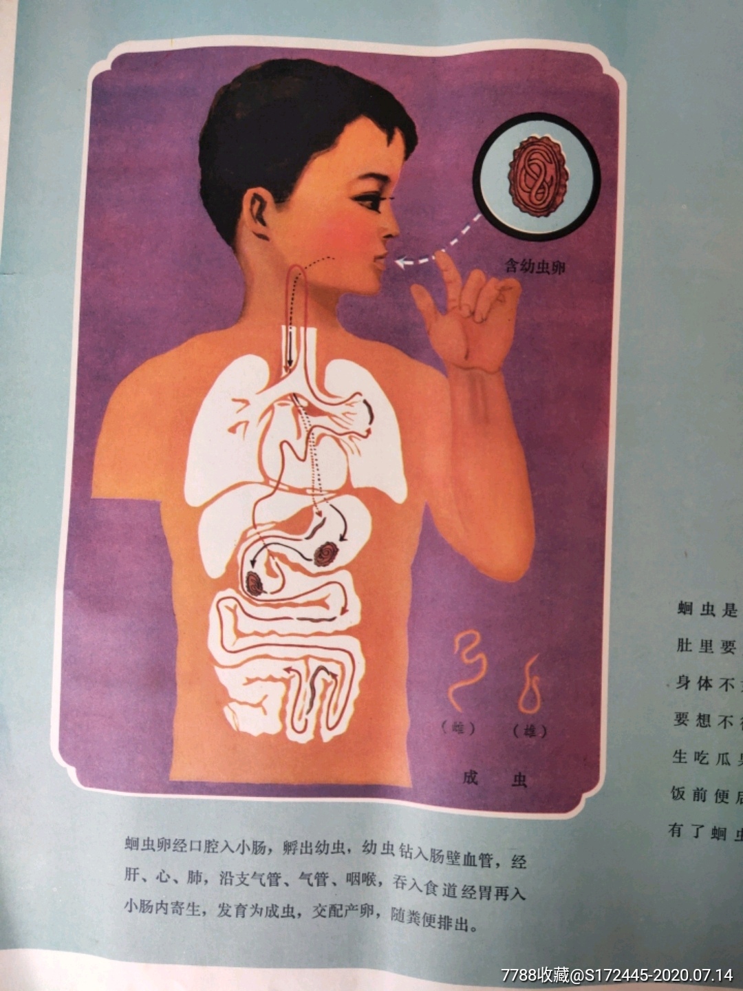 积极预防蛔虫病(挂图)