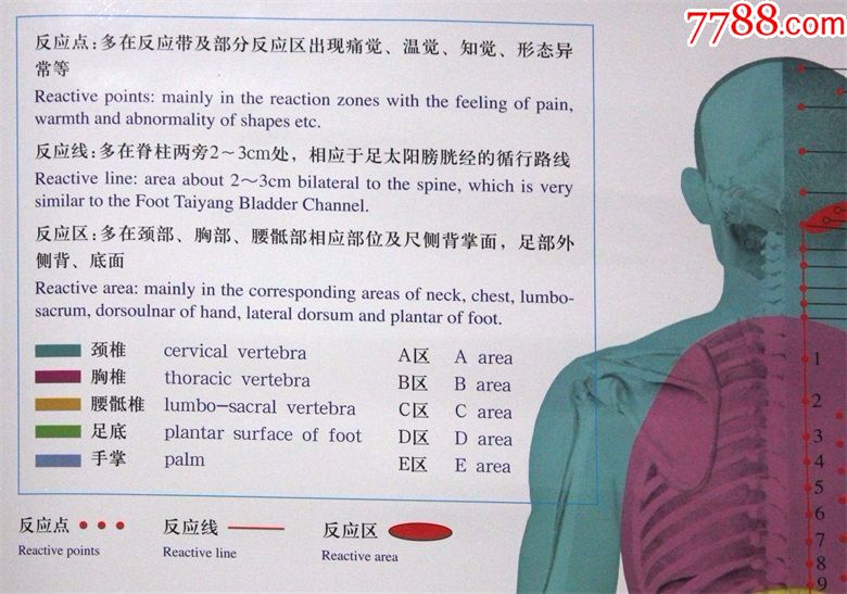 脊柱相关疾病反应点按摩挂图主编:韦贵康北京